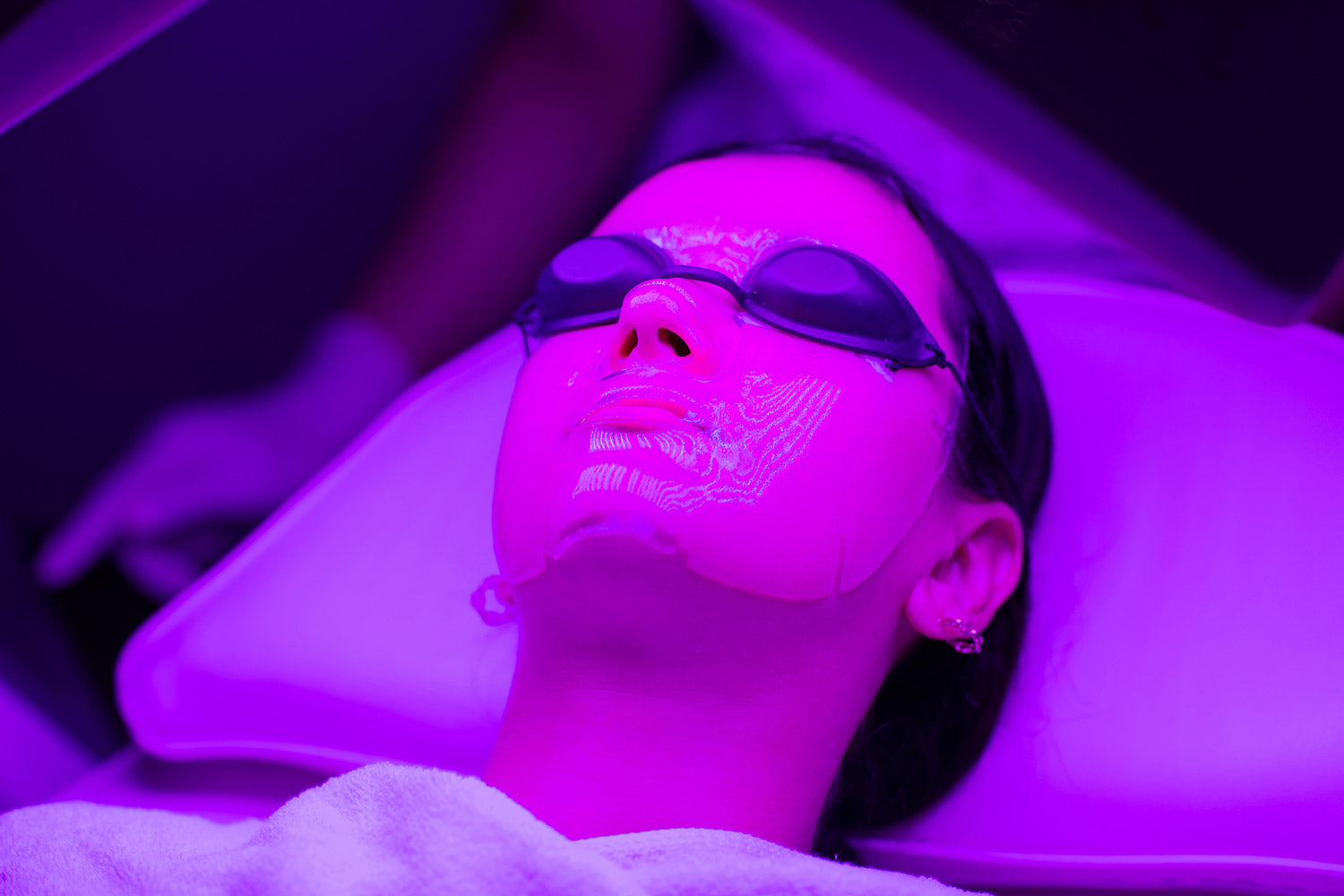 HOW SOON TO SEE RESULTS FROM LED LIGHT THERAPY FOR ACNE