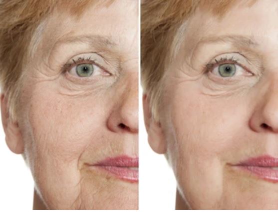 The Effectiveness of LED Light Therapy for Wrinkles