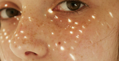 LED THERAPY FOR IMPROVING SKIN TEXTURE AND TONE